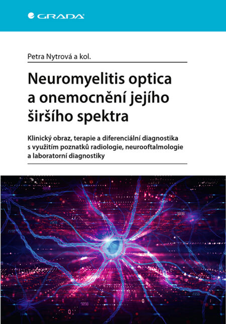 Neuromyelitis optica a onemocnění jejího širšího spektra
